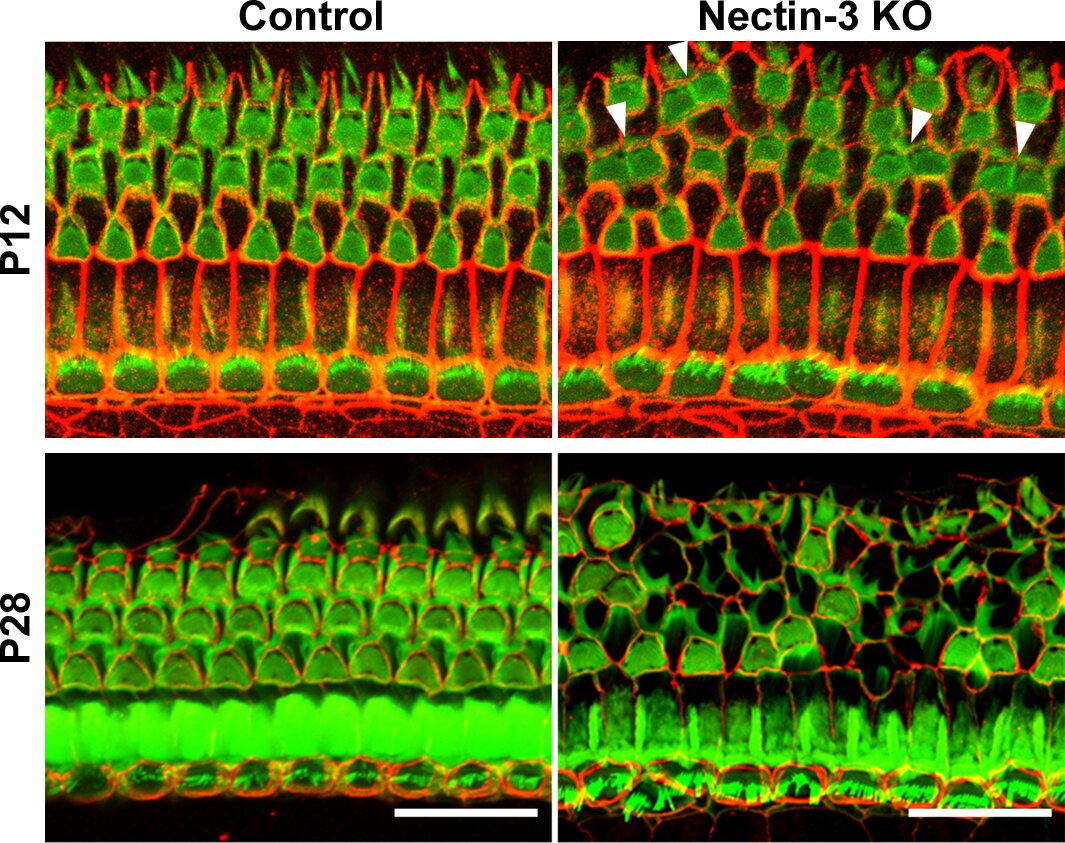 A grid pattern of cells in the inner ear allows us to hear